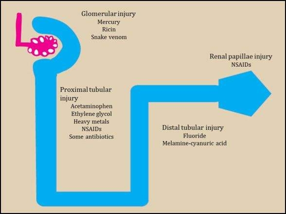 Figura 6.2 Caricatura de una nefrona del riñón que demuestra las diferentes áreas lesionadas por diversos tóxicos