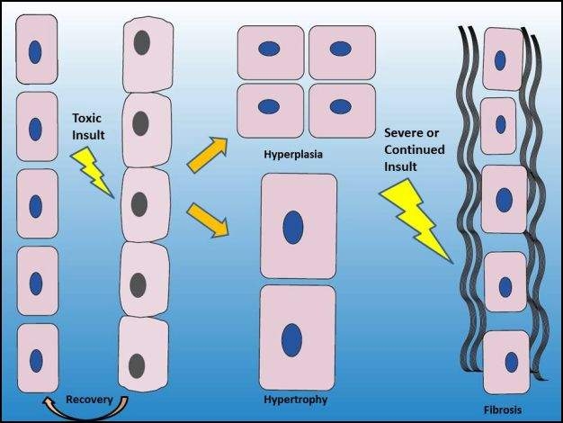 Figura 5.1 Las células normales (a la izquierda) que están expuestas a un ataque tóxico pueden sufrir degeneración, caracterizada por hinchazón celular. Las respuestas de reparación a la lesión celular incluyen aumento del número de células (hiperplasia) y aumento del tamaño celular (hipertrofia). Cuando se expone a un ataque tóxico continuado o cuando la lesión celular es grave, el proceso de reparación puede incluir la formación de tejido conectivo extracelular excesivo (fibrosis).