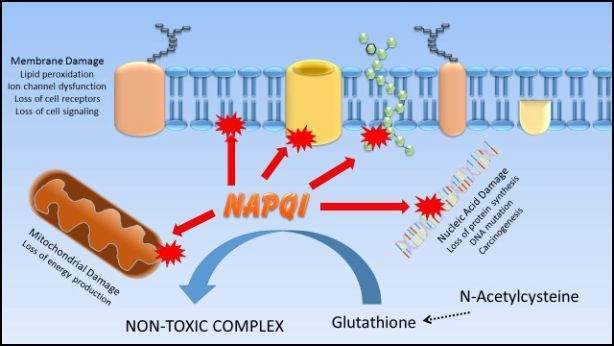 El metabolito del acetaminofén NAPQI normalmente se desintoxica a través de la unión con glutatión. Si el glutatión se agota, NAPQI puede unirse a macromoléculas celulares, lo que resulta en lesiones celulares. Proporcionar el precursor del glutatión n-acetilcisteína ayuda a reponer las reservas de glutatión y mitigar las lesiones inducidas por NAPQI en las estructuras celulares.